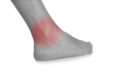 Acute pain in a woman ankle