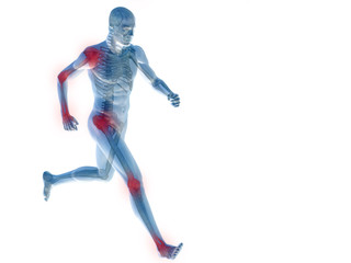 High resolution conceptual 3D human with inflammation