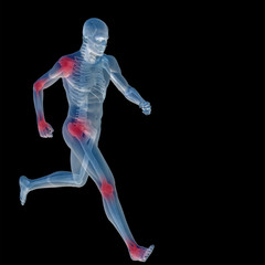 High resolution conceptual 3D human with inflammation