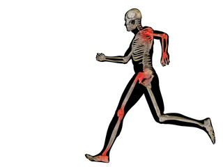 High resolution conceptual 3D human with inflammation