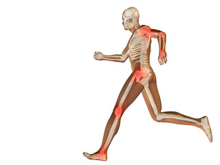 High resolution conceptual 3D human with inflammation