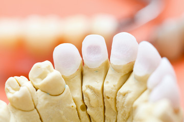 Zircon teeth