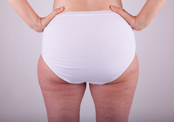 Eine Frau steht in Unterwäsche vor der Kamera