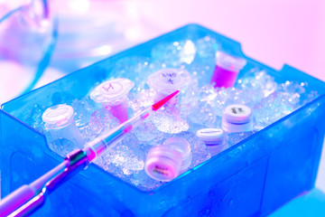 Automatic pipette overreaction tube in a box full of ice