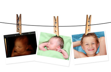 Image of newborn baby like 3D ultrasound and same baby 7 days ol