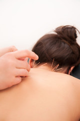 Acupuncture in the neck - 49419386