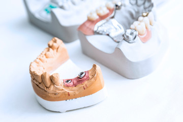 Dental_06