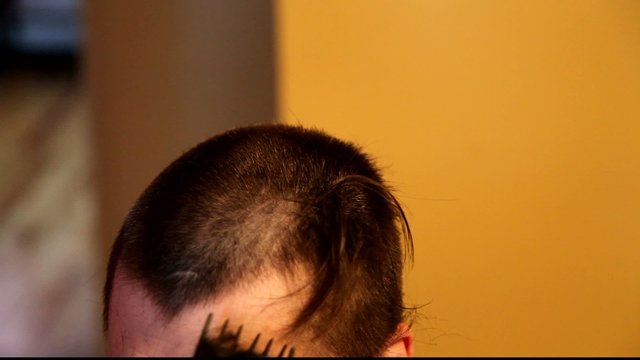 T&ecirc;te ras&eacute;e