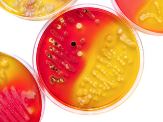 Bacteria colonies on petri dishes, isolated on white