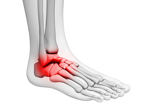 3d rendered illustration - painful ankle