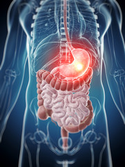 3d rendered illustration - painful stomach