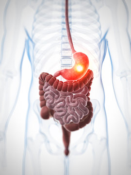 3d rendered illustration - painful stomach