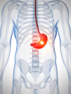 3d rendered illustration - painful stomach
