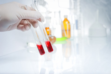 Doctor's hand in glove with blood