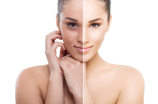 A split photo of a woman before and after retouch