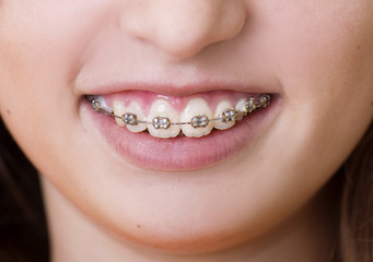 Obraz premium Dental visit