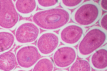 microscopic section of Testis T.S tissue