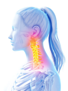 3d rendered illustration of pain in the upper spine