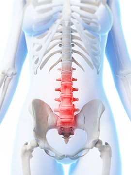 3d rendered illustration of a painful lower spine