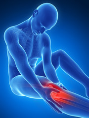 3d rendered illustration of pain in the knee