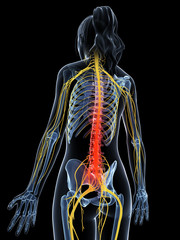 3d rendered illustration of a painful back