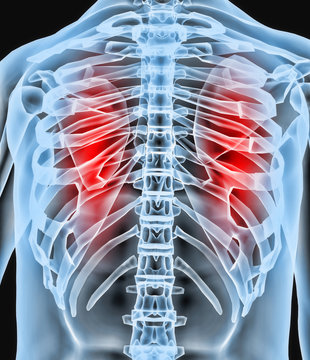 Radiografia aparato respiratorio