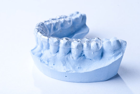 dentales Gipsmodell (Retainer)