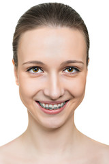 Portrait young woman with brackets on teeth