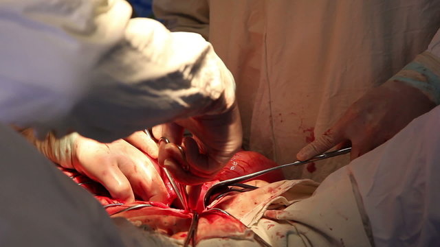 surgery on the abdomen in a sterile operating 6