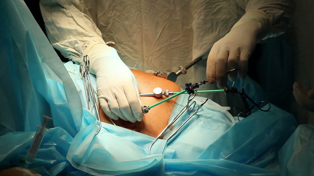Laparoscopic surgery of the abdomen 4