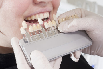 dentist choose white of teeth