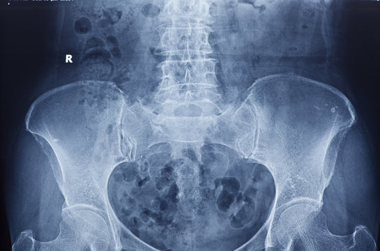 X -ray of spine and pelvis / Many others X-ray images in my port