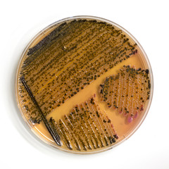 An agar plate with microorganisms