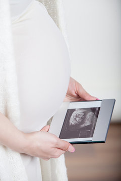 young pregnant woman looking at ultrasound image
