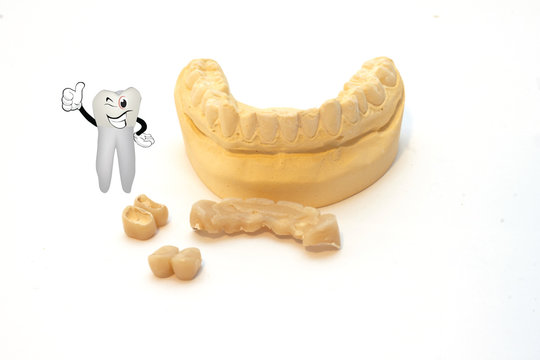 stampo dentiera