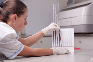 Woman doctor doing erythrocyte sedimentation rate test