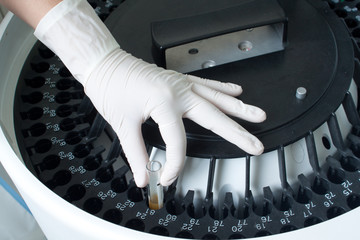 Woman loading samples in analyzer