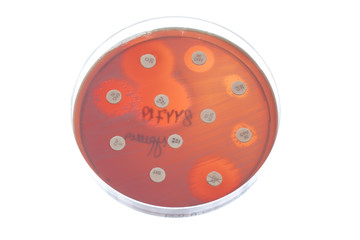 Bacteria on petri dish