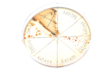 Bacteria on petri dish