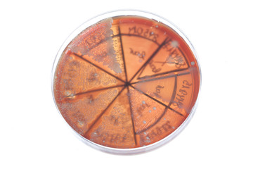 Bacteria on petri dish