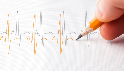 Two lines of heart beats