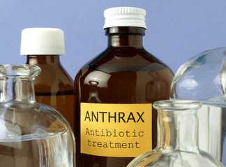 Anthrax laboratory tests