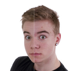 Teenager mit reiner und unreiner Haut