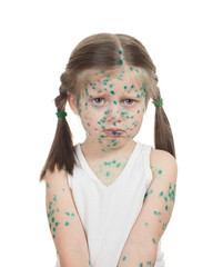 Naklejka premium sick child. chickenpox