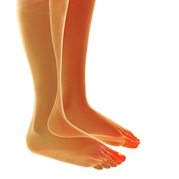 Nagelbettentz&uuml;ndung - 3d Render