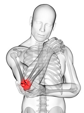 3d rendered illustration of pain in the elbow