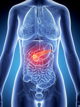 3d rendered illustration of the female anatomy - pancreas cancer