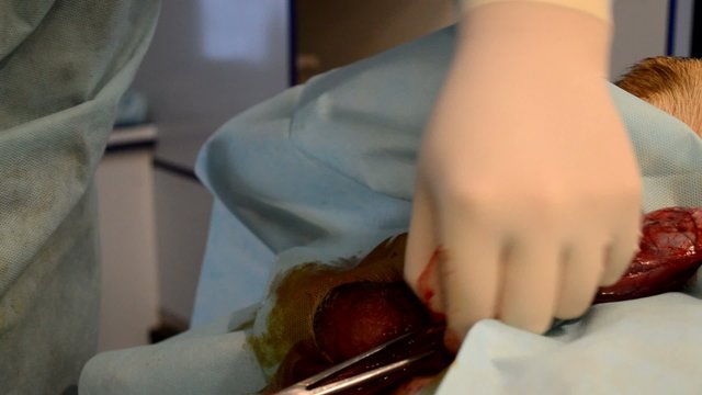 Dog castration, removal of the testis