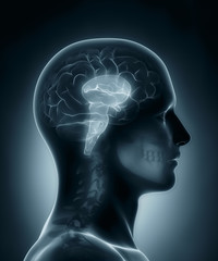 Brain stem medical x-ray scan