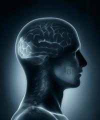 Occipital lobe medical x-ray scan